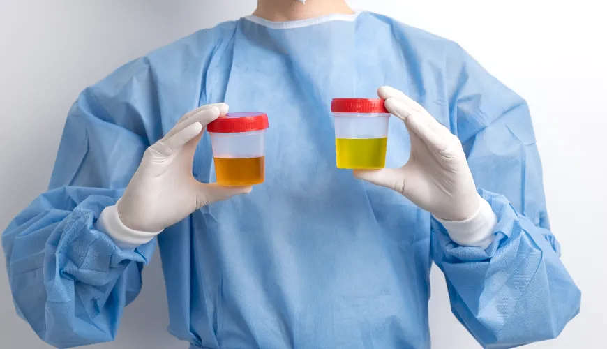 Urine verte et autres changements qui devraient vous inquiéter