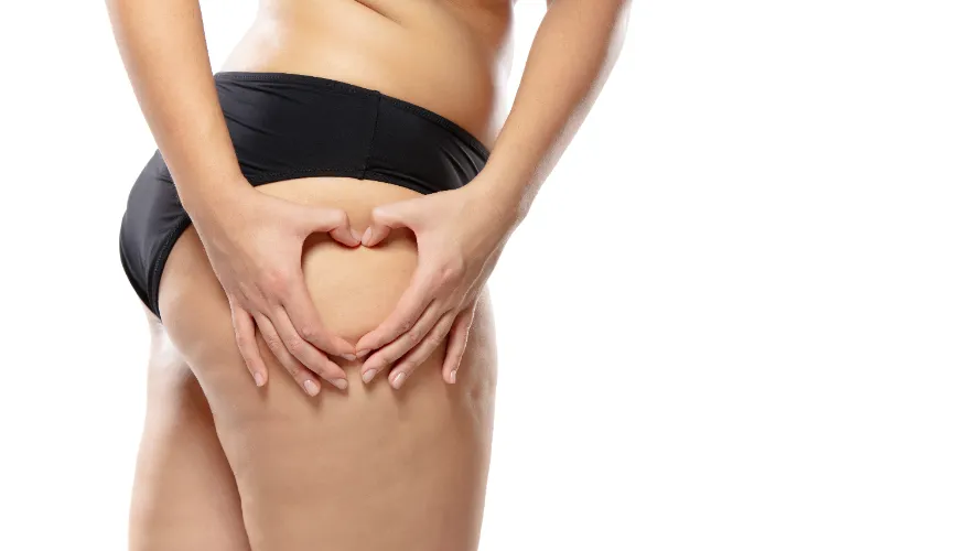 Comment se forme la cellulite et qu'est-ce qui influence sa visibilité